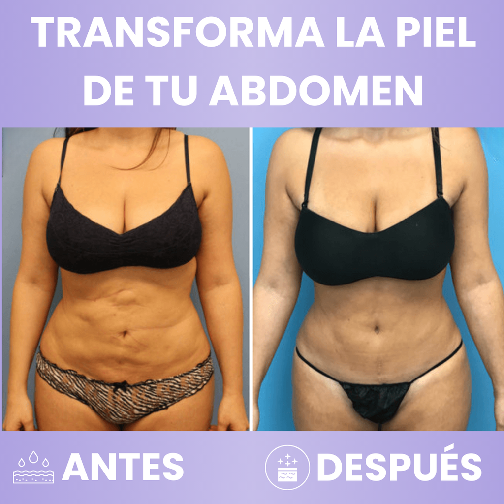 Crema Anti-flacidez Caelia™ / Tratamiento Premium